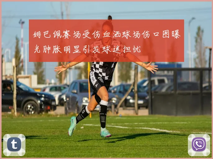 姆巴佩赛场受伤血洒球场伤口图曝光肿胀明显引发球迷担忧